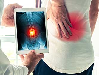 spine pain x ray