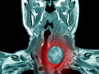 x ray scan