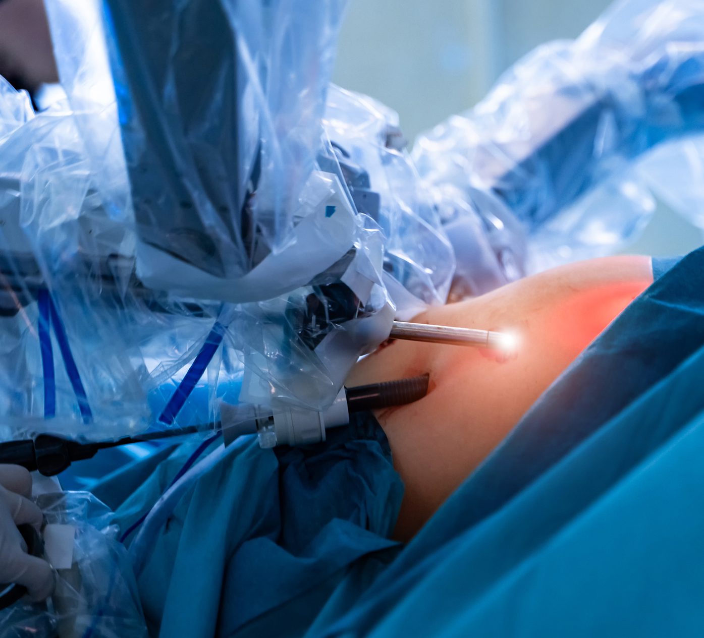 surgical system positioner type ii