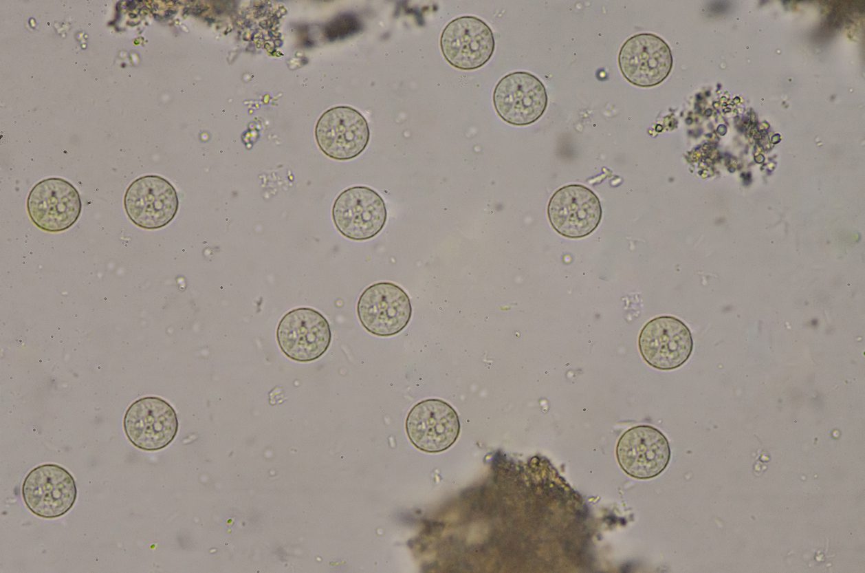 bacteria