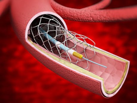 arteries and veins