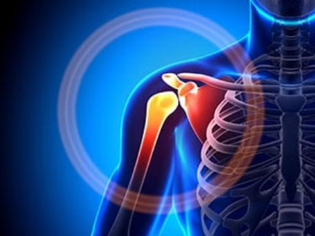 bone transplant defective medical device